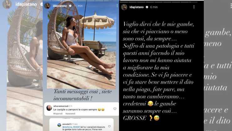 ex protagonista Uomini e donne patologia